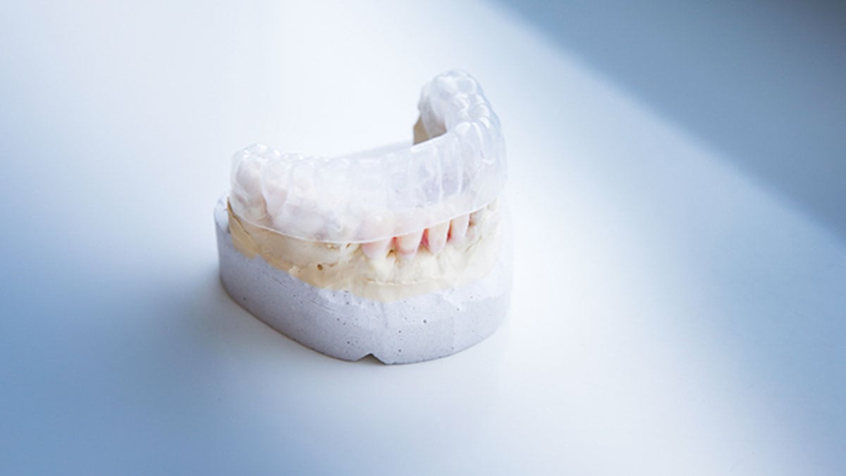 ‘Invisalign’ plastic teeth retainers are now often made with stereolithography 3D printing.