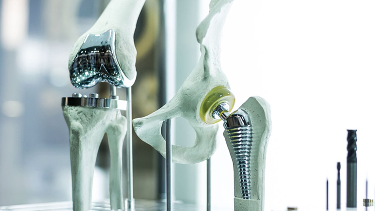 Replacement bones and limbs are more easily achievable thanks to CAD technology